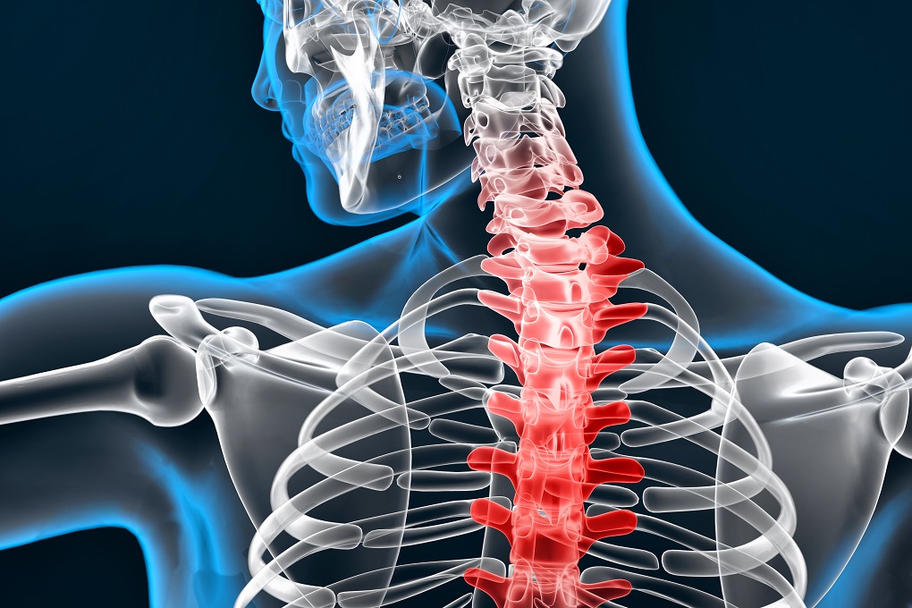 Liệu pháp Chiropractic - Kéo dãn cơ lưng, nắn chỉnh cột sống không đau nhức